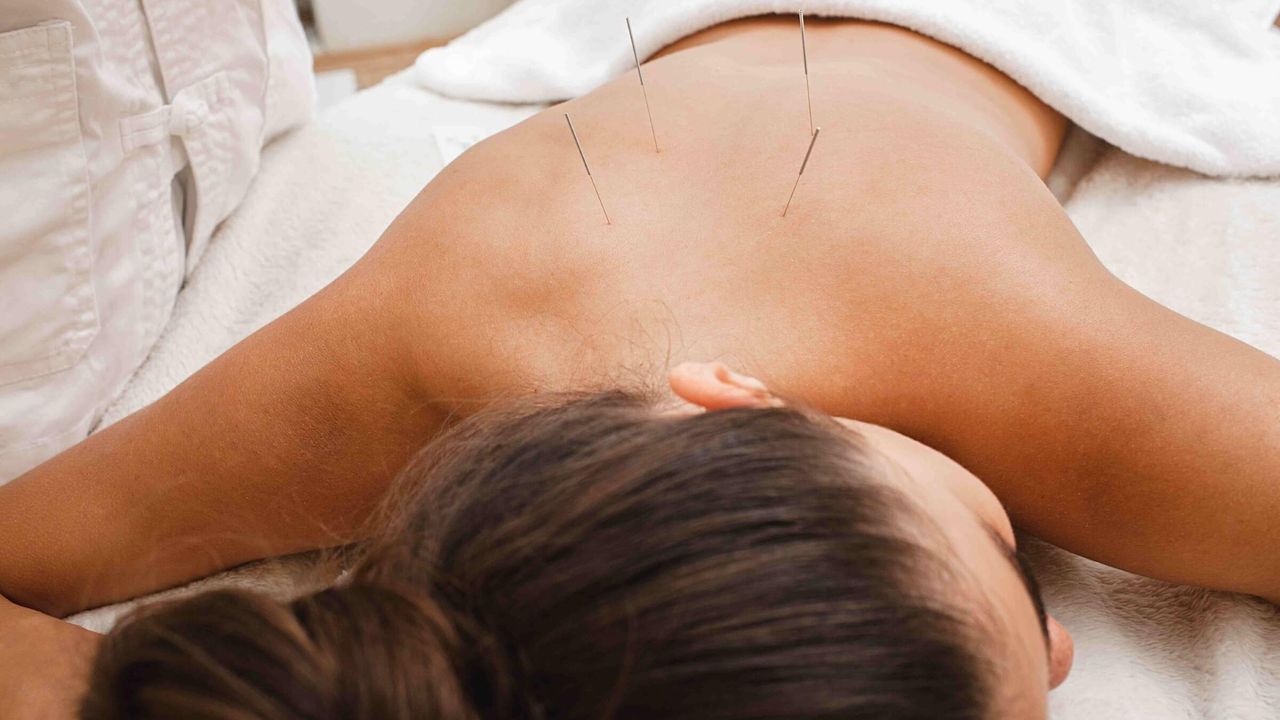 Erhält Akupunkturbehandlung für Wohlbefinden und Regeneration
